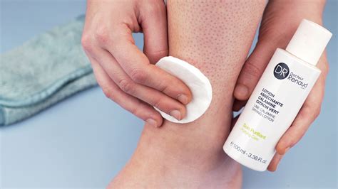 9 Easy Ways to Soothe and Heal Razor Bumps on Your Legs