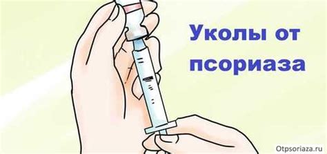 Уколы от псориаза – виды инъекций, особенности лечения, отзывы