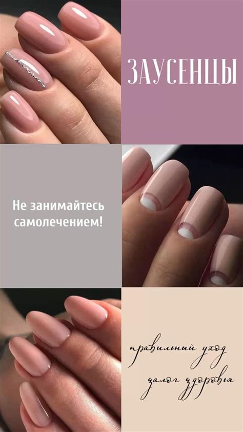 Маникюр. Ногти. Заусенцы. | Здоровые ногти, Маникюр, Ногти
