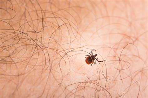 Ticks (Ixodida) | NaturePest