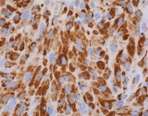 pathology outlines case   month