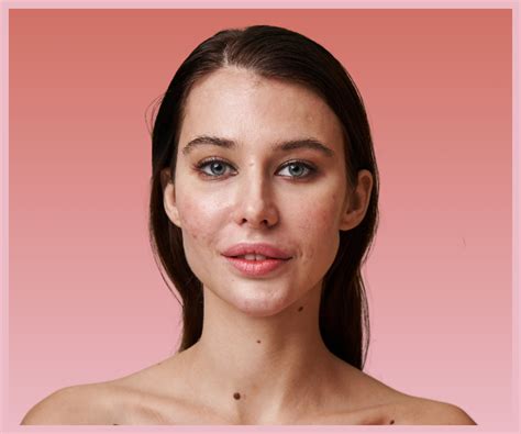 Skin Concerns We Treat — The Skin Manifesto