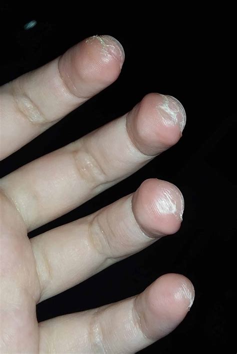 Is Learning Guitar Hard? Yes! But Don't Be Put Off - Guitar Inside Out