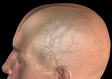 Hematoma Na Cabeça Após Queda