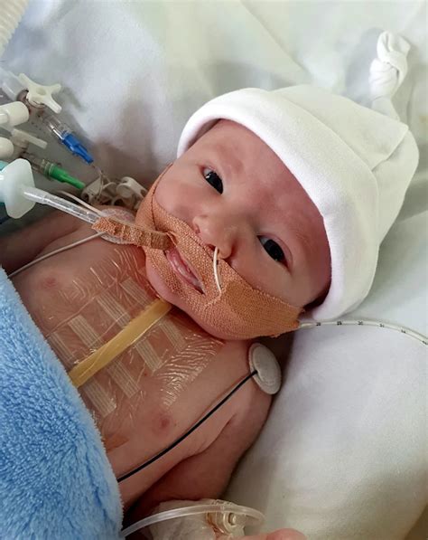 Mum shares heartbreaking pictures of baby recovering from lifesaving ...