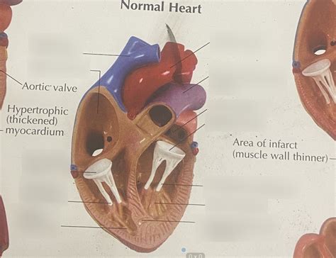 Heart Disease- Normal Diagram | Quizlet