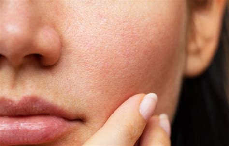 3 Natural Ingredients You Need to Reduce Pores - iSkinCareReviews