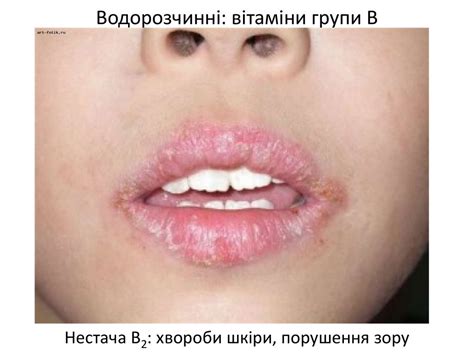 Вітаміни - презентация онлайн