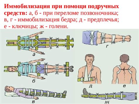 Способы иммобилизации и переноски пострадавшего