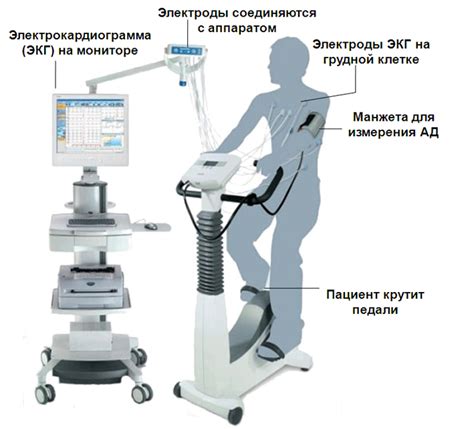 ЭКГ пробы с дозированной физической нагрузкой, стресс-тест | Ассоциация ...