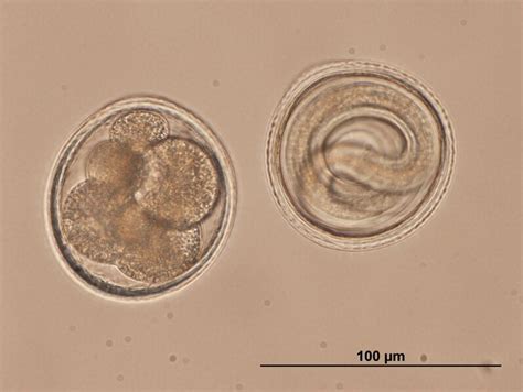 Toxocara IgM — New Life Diagnostics
