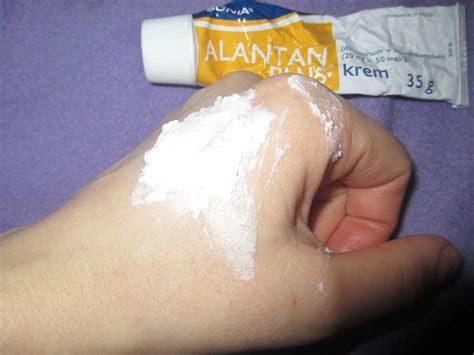 Sanitariuszka Urody: ALANTAN PLUS krem