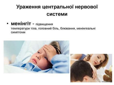 Епідемічний паротит - презентация онлайн