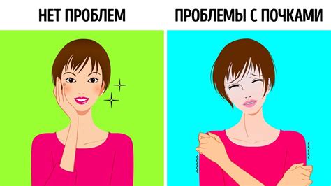 10 Неочевидных Признаков, что Ваши Почки Плохо Работают - YouTube