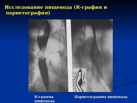 Методы диагностики в рентгенологии. Лекция 2 - online presentation