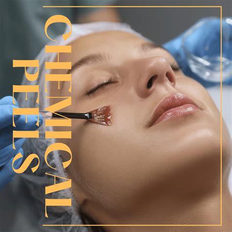 Chemical Peels | Product | London Aesthetics
