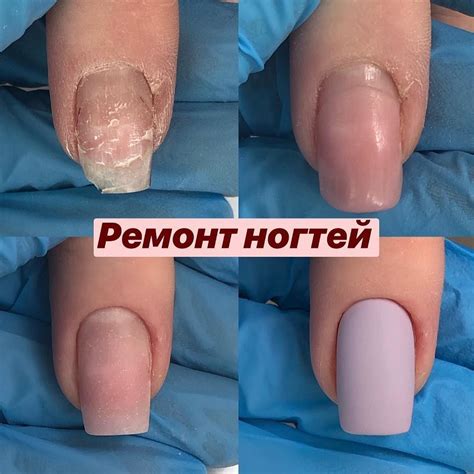 Что делать, если сильно сломался ноготь, как починить?