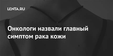 Онкологи назвали главный симптом рака кожи: Здоровье: Наука и техника ...