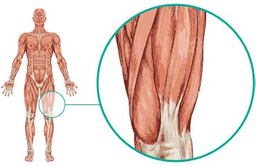 Front Thigh - Causes & Treatments | Local Physio