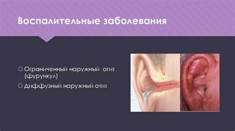 Анатомия физиология и патология наружного уха 2015 Шаварова
