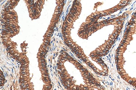 akrc antibody   ap proteintech