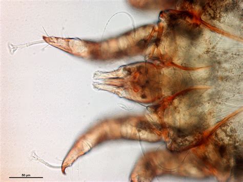 Detail of the anterior part of Psoroptes cuniculi showing long jointed ...
