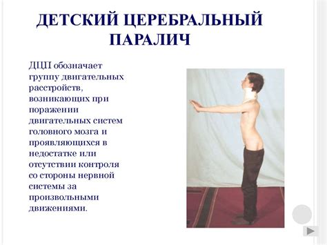 Нарушение опорно-двигательного аппарата у детей - презентация онлайн