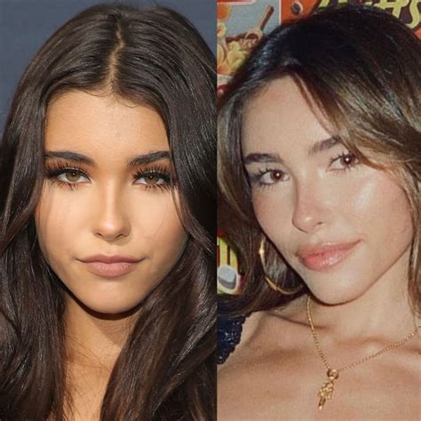 Madison Beer Plastic Surgery: Lip Filler, Face Lift, and More
