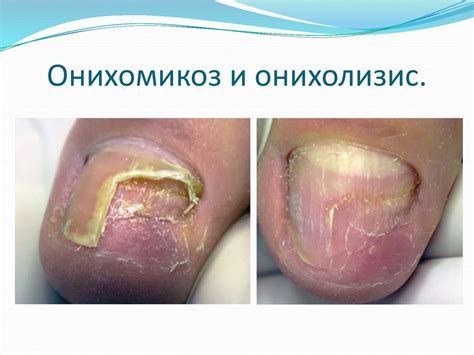 Современный педикюр - online presentation