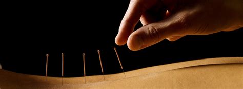 Woman getting an acupuncture treatment in a spa - Escuela Li Ping de ...