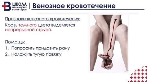 Травмы. Раны. Кровотечения. Школа медицинских волонтеров - online ...