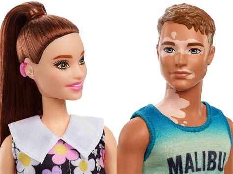 Real Life Ken Before And After Body