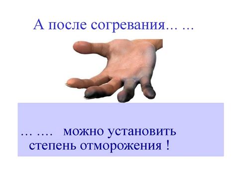 Первая помощь при отморожении - презентация онлайн