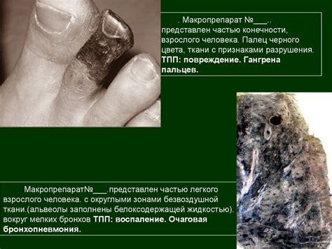 Макропрепараты к экзамену по патанатомии - презентация онлайн
