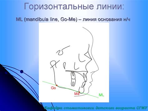 Анализ ТРГ в клинике ортодонтии - презентация онлайн