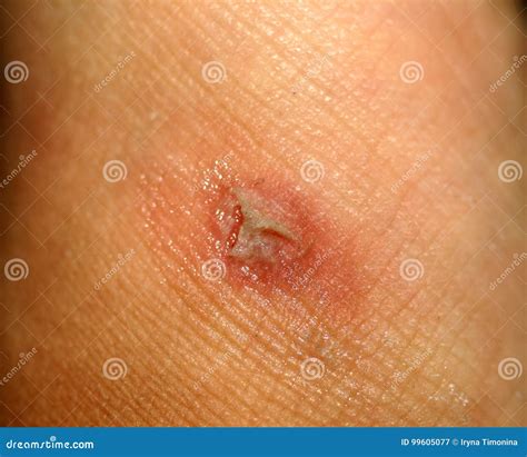 corn   skin  corn popped stock image image  care