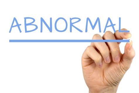 Abnormal - Free of Charge Creative Commons Handwriting image