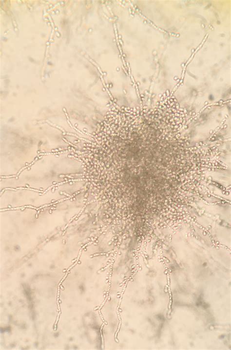 Candida parapsilosis