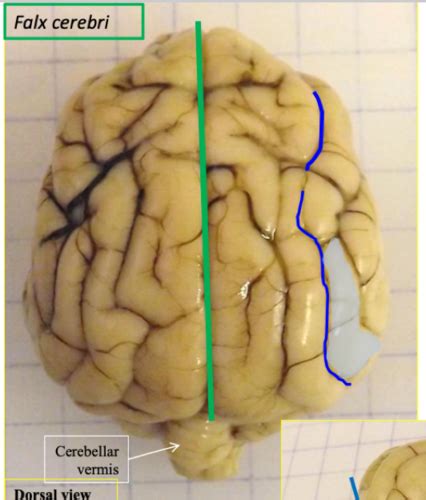 CNS Histology Flashcards | Quizlet