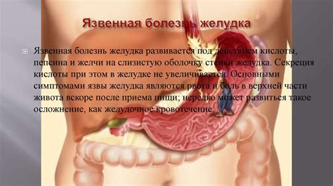 Первичная профилактика заболеваний ЖКТ - презентация онлайн