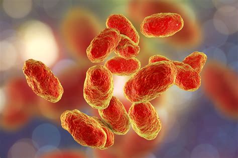 Monitoring Protein Expression in Haemophilus Influenzae using 2D Semi ...