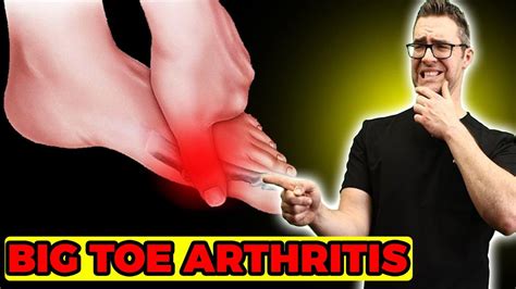 big toe knuckle pain  symptoms   treatment