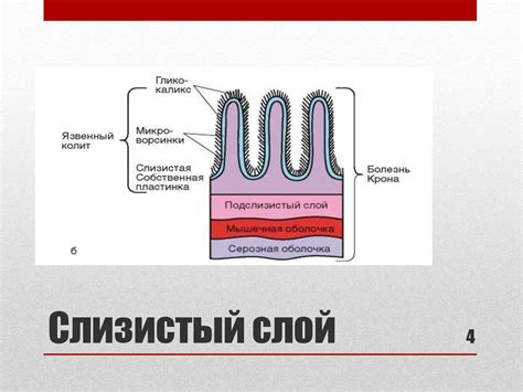 Сравнительная характеристика болезни Крона и НЯК - презентация онлайн