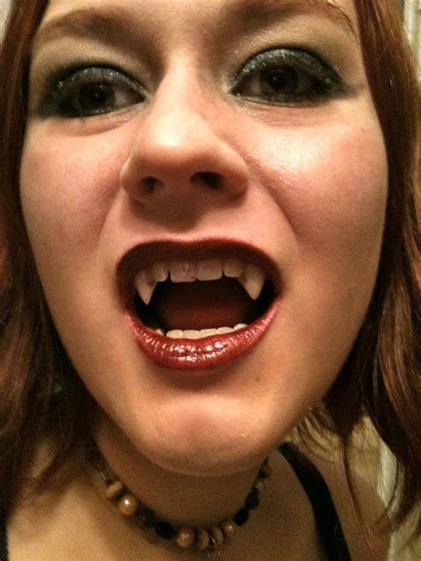 Vampire Fangs : r/vampirefangs