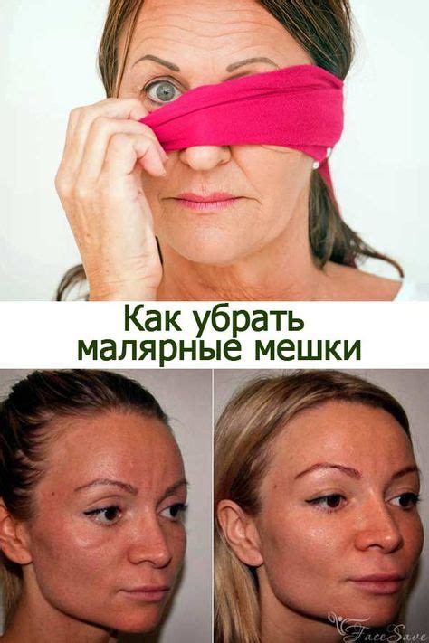 Можно ли избавиться от суфов самостоятельно, не прибегнув к услугам ...