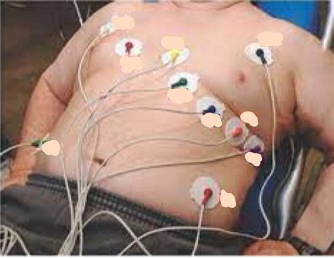 lead ekg ecg placement diagram quizlet