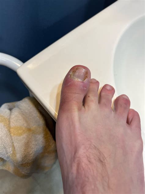 Has anyone ever used EasyPatches Correction patches for beautiful and