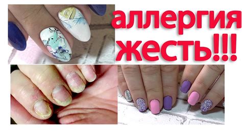 Дизайн ногтей МЫШОНОК. Аллергия на гель лак. Маникюр 2020 - YouTube