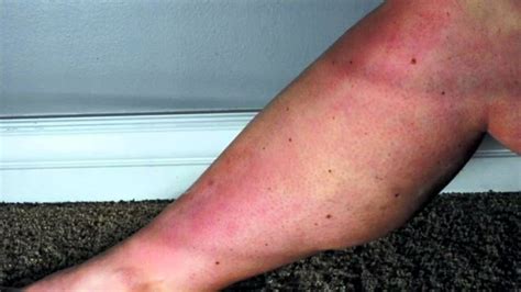 sugaring paste hair removal youtube