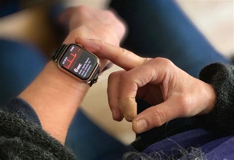 Apple Watch ECG already finding stealth heart problems | Cult of Mac